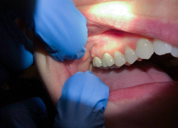 Best Emergency Broken Tooth Repair in Nashville, AR
