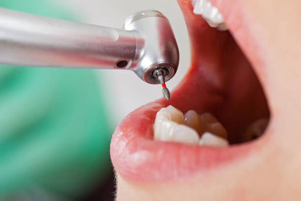 Best Same-Day Emergency Dentist in Nashville, AR